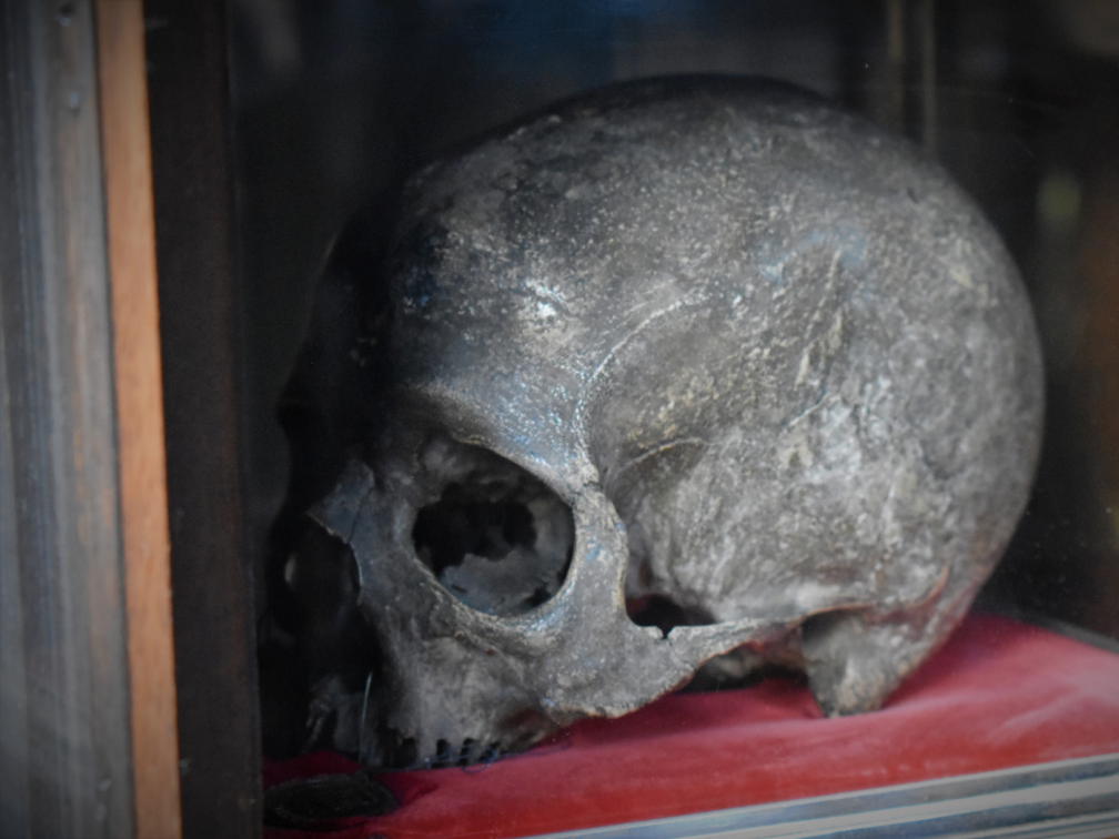 The skull of Ambrose Barlow, a relic preserved at Wardley Hall